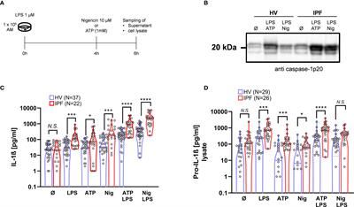 The NLRP3-Inflammasome-Caspase-1 Pathway Is Upregulated in Idiopathic Pulmonary Fibrosis and Acute Exacerbations and Is Inducible by Apoptotic A549 Cells